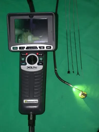 Le nouveau vidéoendoscope d'EVEREST VIT FRANCE