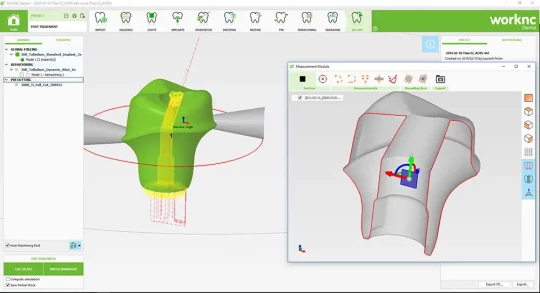 Usinage de puits de vis angulés sur prothèse, usinage connectique implant