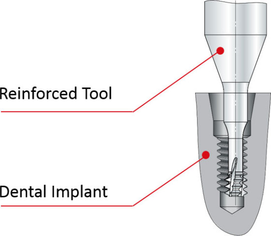 vargus millipro dental