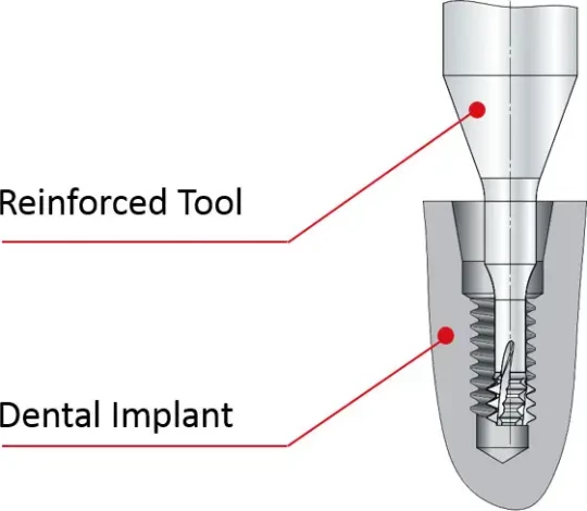 Fraise de filetage conçue pour les implants dentaires
