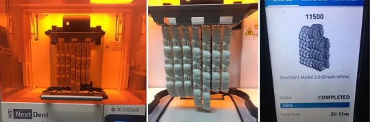 Impression haute précision de modèles orthodontiques par empilement vertical